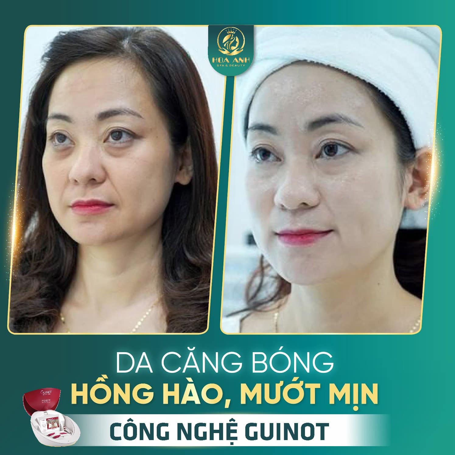 Xóa Nhăn – Căng Cơ Guinot